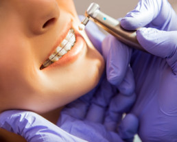 photo showing braces check up