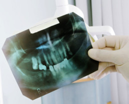 photo of dental xray